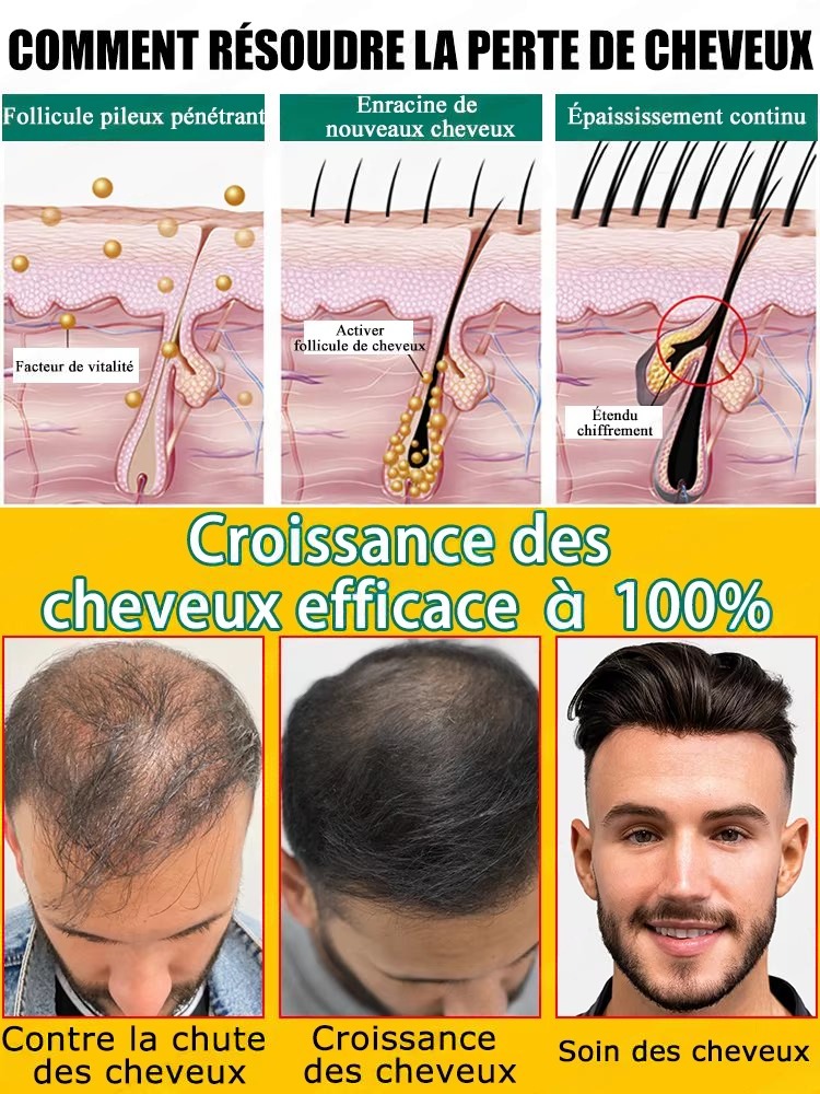Ingrédients végétaux doux pour - Hair Care Natural Ingredients avis et prix