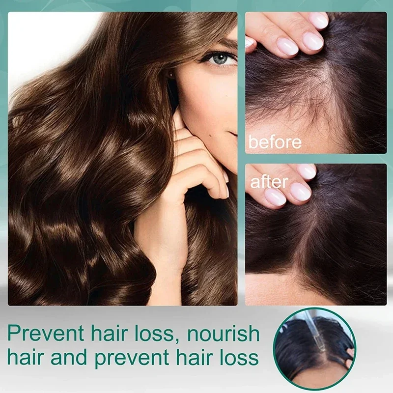 Traitement liquide à quatre he - Hair Care Natural Ingredients avis et prix