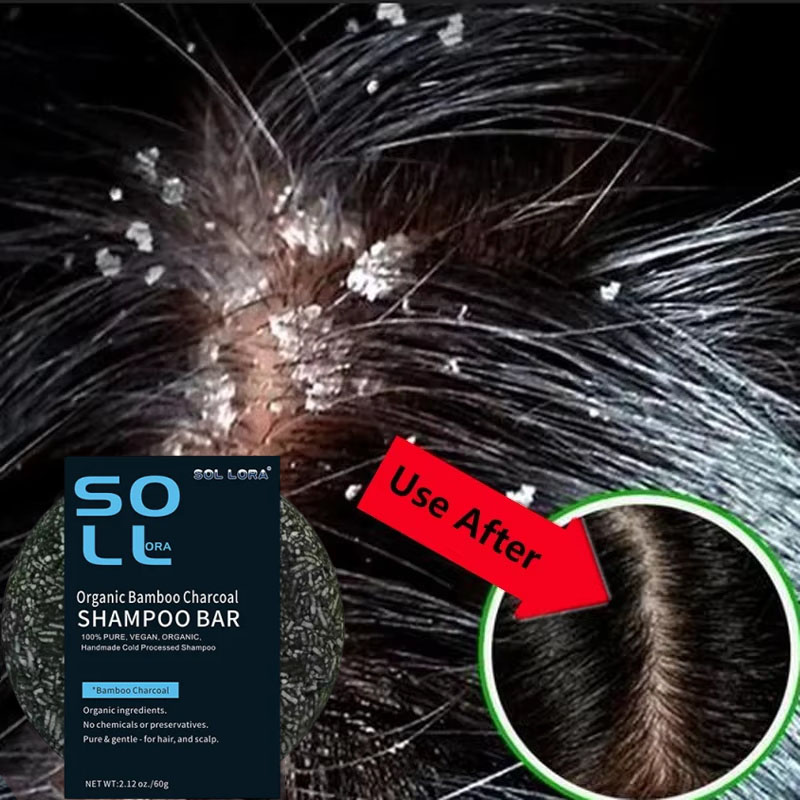 Savon de traitement Anti-pelli - Hair Care Dandruff avis et prix