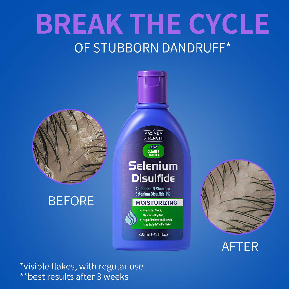 Shampoing antipelliculaire au  - Hair Care Dandruff avis et prix